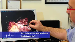 Robotik cerrahi ile hangi ameliyatlar yapılabilmektedir? | Prof. Dr. Fatih Ağalar