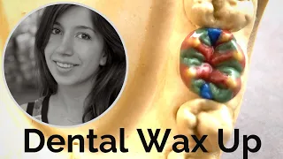 Dental Wax Up for Exam [Tutorial]