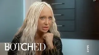 Did Woman Get Sheep's Fat Injected in Lips?! | Botched | E!