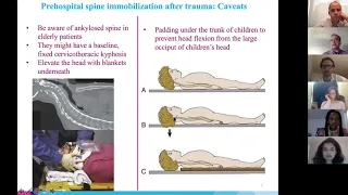 Medical Student Lecture Series - Spine Trauma