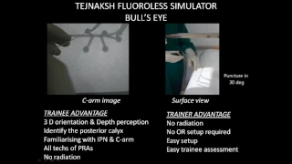 TEJNAKSH'S FLUOROSCOPY FREE PCNL SIMULATOR - Bull's Eye Technique