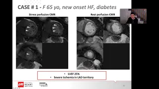 Imaging for the cardiac surgeon part 1 Mongeon