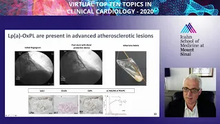 Subcellular Therapeutic Targeting of Common Lipid Disorders - Dr. Sotirios Tsimikas