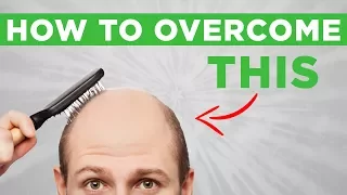 Hair Loss: How I'm Handling Going Bald — and How You Can Conquer Your Own Insecurities