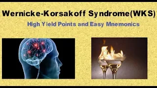 Wernicke-Korsakoff Syndrome:High Yield Points and Easy Mnemonics