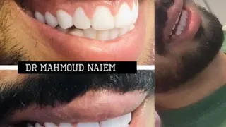 صفوة المهيدب لطب الاسنان فرع اشبيليا دكتور محمود نعيم