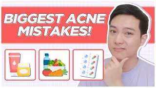 ACNE MISTAKES to AVOID for CLEAR SKIN! My Acne Journey Mistakes (Filipino) | Jan Angelo