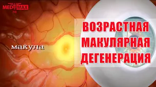 ВМД - возрастная макулярная дегенерация. Причины #возрастнаямакулярнаядегенерация#офтальмология#вмд