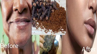 How to Mix clove with water to look 10 years younger than your age/anti ageing secret