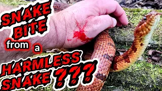 Snake Bite from a "HARMLESS" Snake???