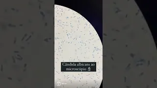 Microscopia - Candida albicans