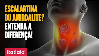 ESCOLAS FECHADAS POR BACTÉRIA: ENTENDA O QUE É ESCARLATINA E A DIFERENÇA DA DOENÇA PARA AMIGDALITE