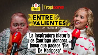La inspiradora historia de Santiago Monarca, joven que padece 'Piel De Mariposa'