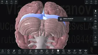 Оболочки головного мозга на интерактивном атласе "Пирогов"