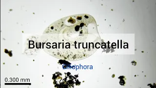 Bursaria truncatella (Ciliophora)