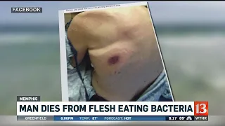 Man dies from flesh eating bacteria