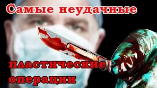 Pro100% ПРАВДА - Самые неудачные пластические операции