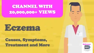 Eczema - Causes, Symptoms, Treatment and More