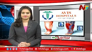 Reasons And Treatment For Varicose Veins Explained By Dr. Rajah V Koppala | Avis Hospitals