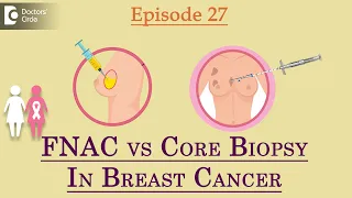 FNAC vs CORE BIOPSY for Breast-What is the difference?-Dr.Sandeep Nayak| Samrohana | Doctors' Circle