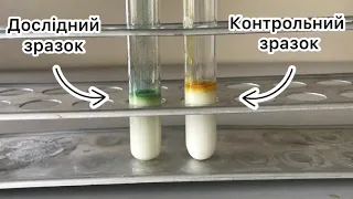 Контроль якості молока. Дослідження фальсифікації молока водою, додаванням соди, борошна та крохмалю