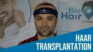 Haartransplantation Istanbul - Erfahrungen aus der Türkei