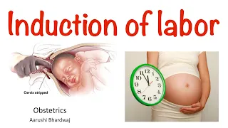 Induction of Labor (in Hindi) | Obstetrics