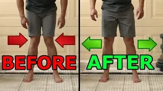 5 Ways To  Fix Knocked Knees | Tight Inner Thighs