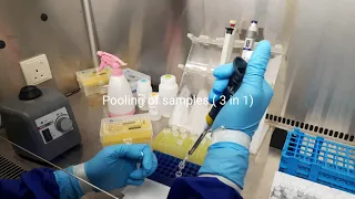 Coronavirus nucleic acid extraction for  RT PCR fully guided