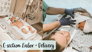 EMOTIONAL C-SECTION AT 38 WEEKS LABOR AND DELIVERY VLOG 2020