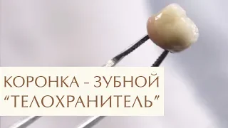 🤔 Зачем и когда нужно ставить коронку на зуб: ответ стоматолога. Зачем ставить коронку на зуб. 12+