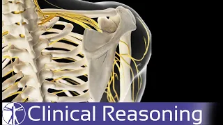 Does Your Patient Really Have Thoracic Outlet Syndrome (TOS)?