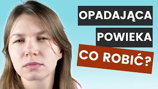 Opadająca POWIEKA - Zabiegi i Domowe Sposoby | Lekarz Wyjaśnia Co Zrobić Na Opadające Powieki!