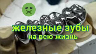 МЕТАЛЛИЧЕСКИЕ зубные коронки. КОРОНКА металлическая цельнолитая.