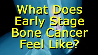 What Does Early Stage Bone Cancer Feel Like?