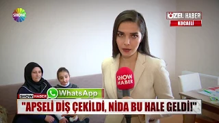 "Apseli diş çekildi, Nida bu hale geldi!"