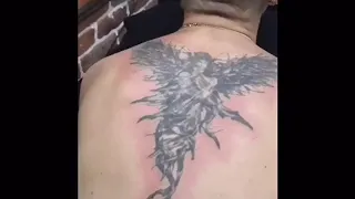 Удаление татуировки лазером в Москве