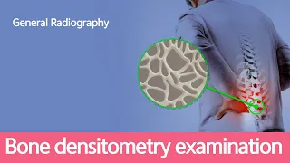 [General Radiography] Bone densitometry examination