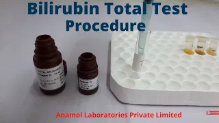 Bilirubin Test Procedure | Bilirubin Total Test