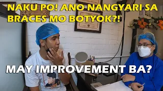 NAKU PO! BOTYOK ANO NANGYARI SA BRACES MO? | Papadinz TV