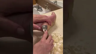 FOOT SHAVING DAY PART 3 - Callus removal on foot w/ EPPK Keratoderma Hyperkeratosis  - Apr 28, 2023