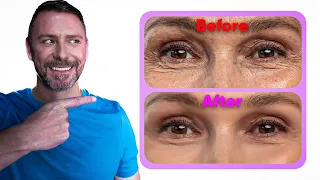 THIS EYE CREAM HACK WILL BLOW YOUR MIND! (LINES BE GONE!)