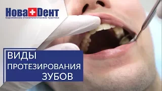 Протезирование зубов при полной потере. 🔬 Варианты протезирования при полной потере зубов. НоваДент