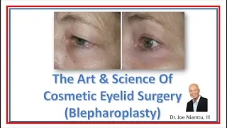 The Art and Science of Cosmetic Eyelid Surgery (Blephaorplasty)