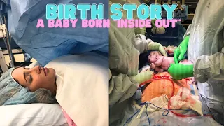 BIRTH STORY | HIGH RISK DELIVERY + C SECTION | GASTROSCHISIS