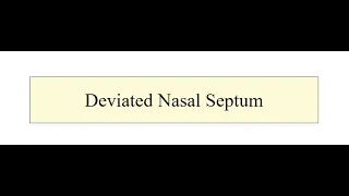 Deviated Nasal septum