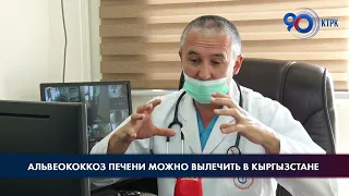 Альвеококкоз печени можно вылечить в Кыргызстане