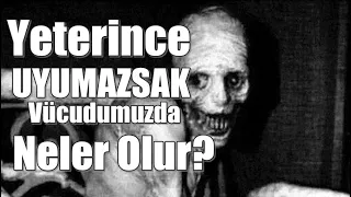 Yeterince Uyumazsak Vücudumuzda Neler Olur?