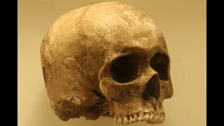 Skull - External base of the skull