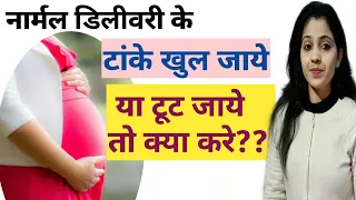 डिलीवरी के बाद टांके खुल जाये या टूट जाये तो क्या करे?